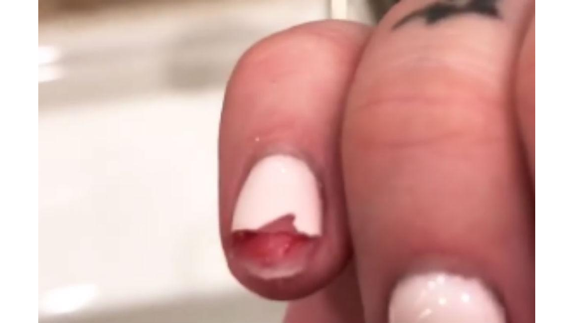 iggy-azalea-rips-finger-nail-off-8days