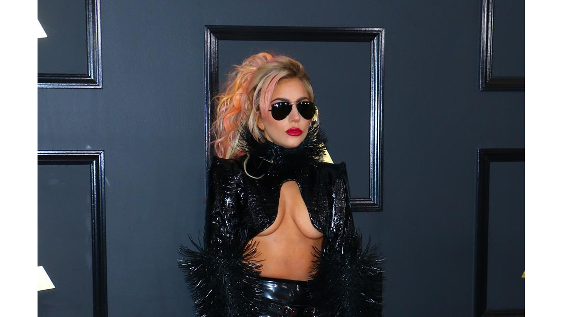 Lady Gaga halted show to help bleeding fan 8days