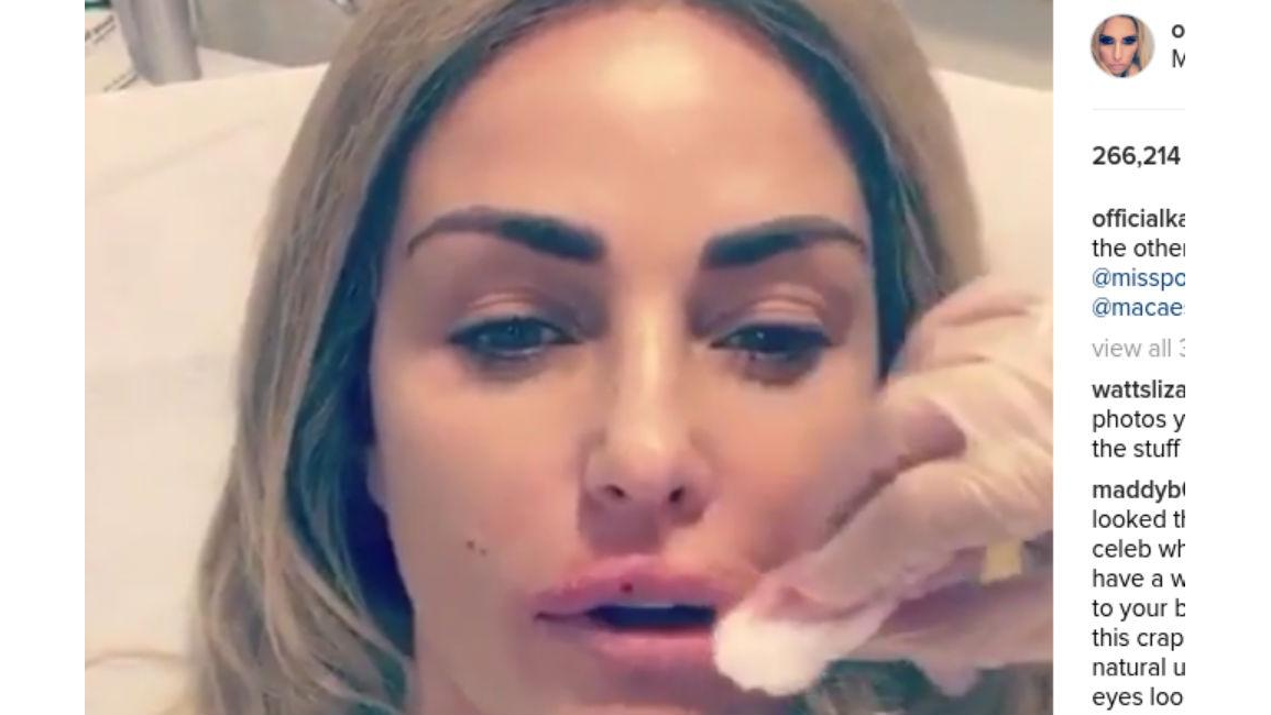 Katie Price Gets Her Lips Plumped 8 Days 5817