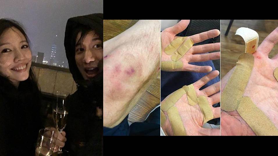 Wang Leehom sustains injuries on new action film - 8days