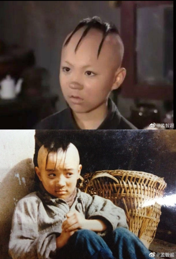 Former Child Star Needed Hair Transplant Surgery After Shaving His Head  Many Times As A Kid; This Is What He Looks Like Now - 8Days