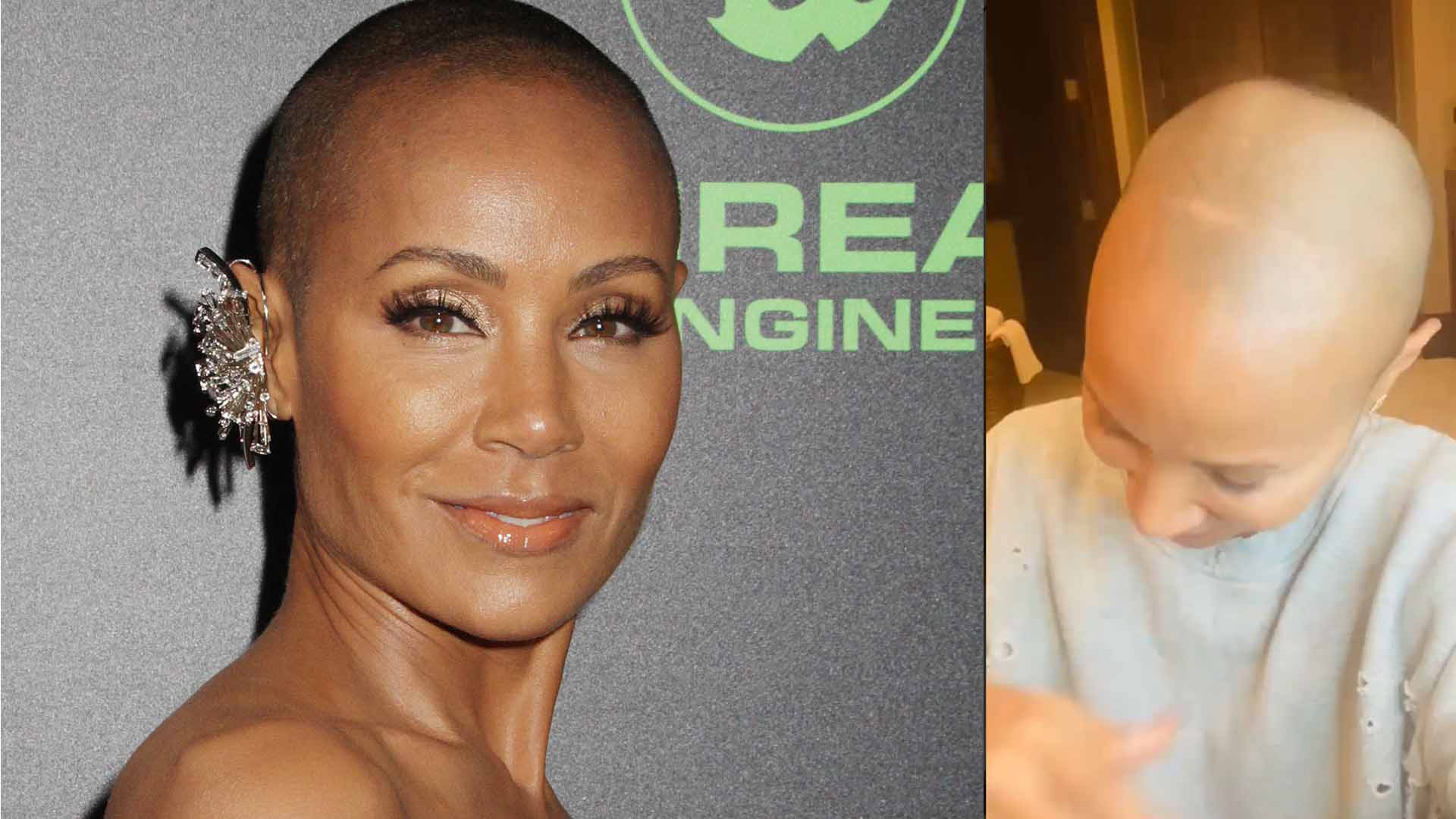 Jada Pinkett Smith Embraces Hair Loss In Instagram Post: “Me and This  Alopecia Are Going to Be Friends” - 8days