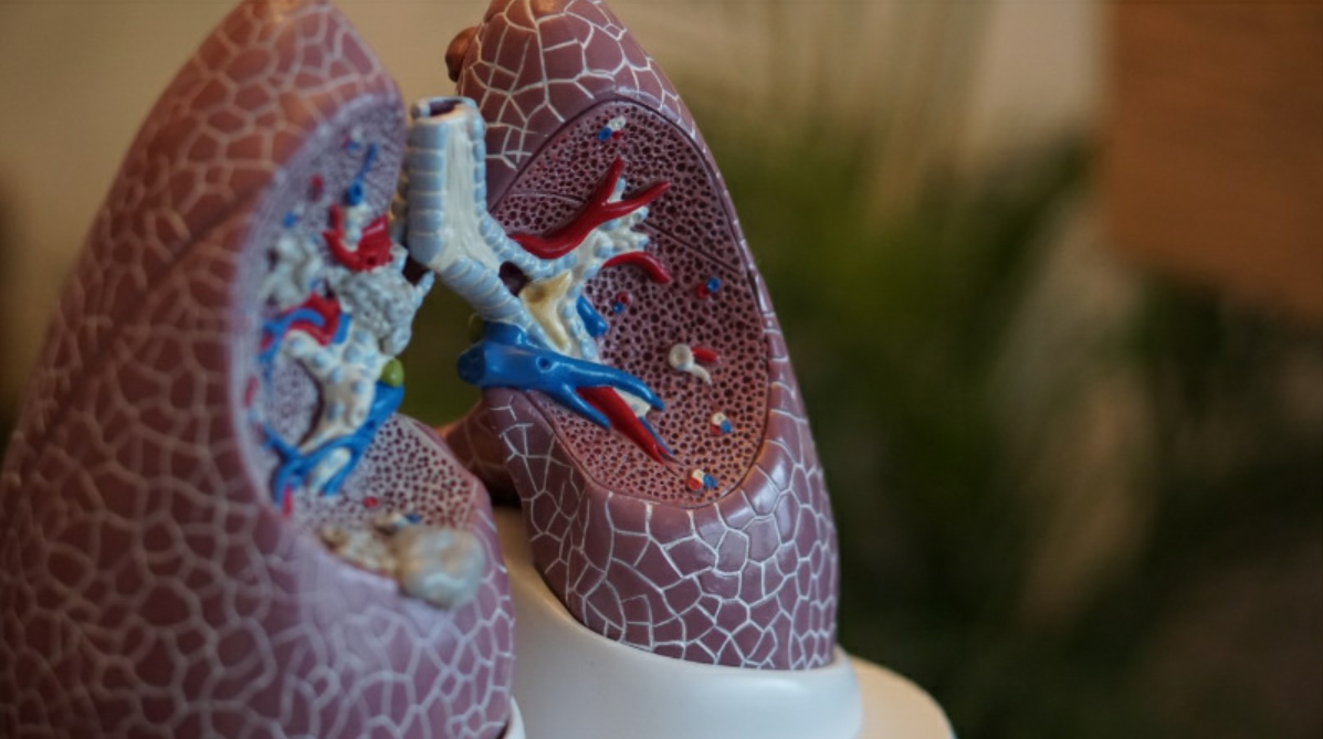 lung model