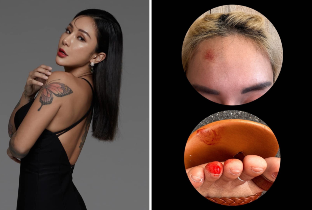 Taiwanese Rapper Nana Liang Left Bleeding After Accident In Taxi; First  Thing Driver Did Was Ask Her To Pay The Fare - 8days