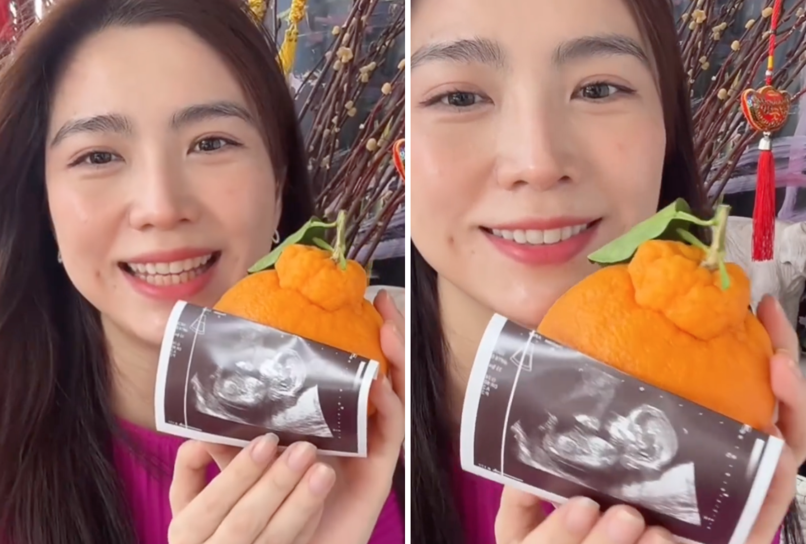 Ex Mediacorp Actress Sora Ma, 39, Is Pregnant; Baby Is Due In August - 8days