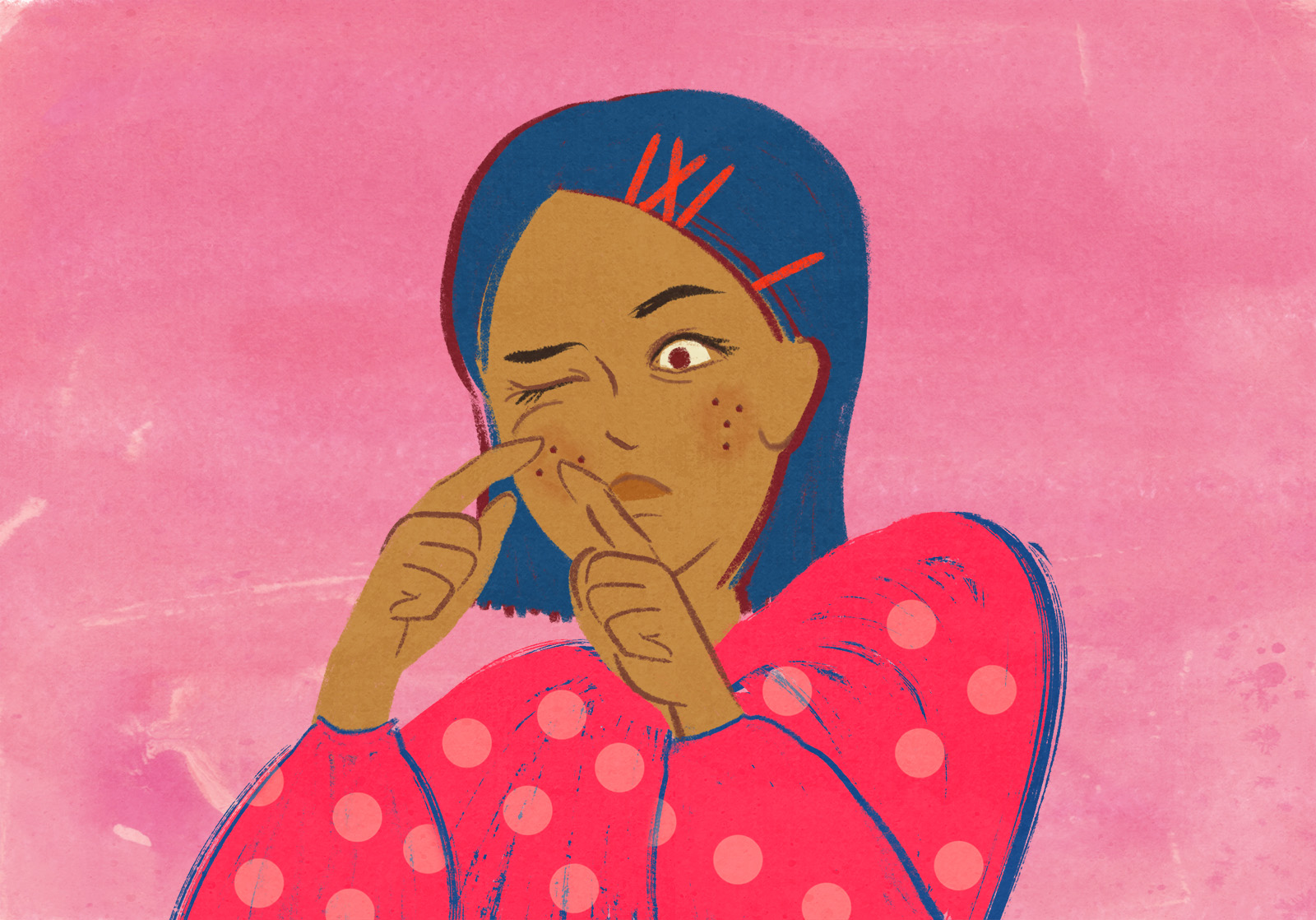 How to deal with adult acne in your 20s, 30s and 40s – and why your teen routine won’t cut it